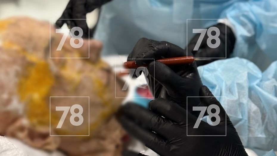 Обучение на частях тел 